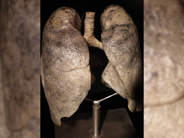 ¡Te invitamos a conocer las maravillas del cuerpo humano! - ¿Qué hacen los pulmones por nosotros?