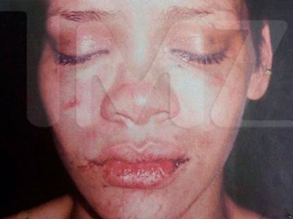 Famosos que pierden el control - Rihanna, quedó desfigurada