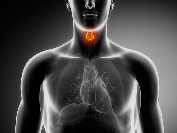 El cáncer asume el poder - ¿Qué es el cáncer de tiroides?