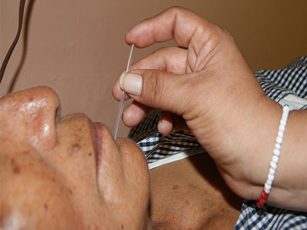 6 problemas que se solucionan con acupuntura - ¿Cómo funcionan las agujas?