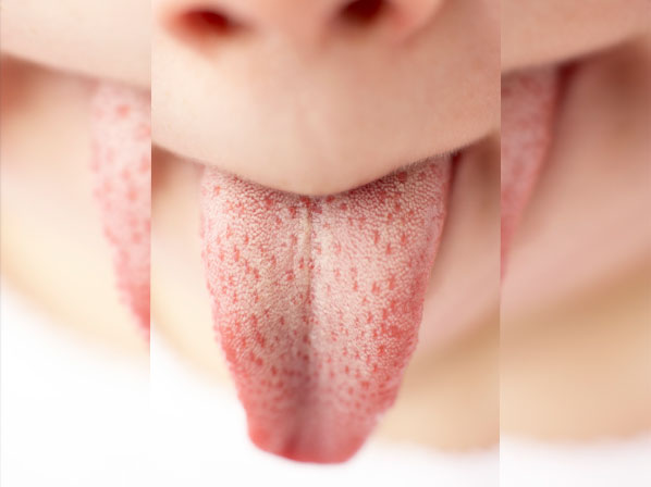 8: ¿Presentas manchas blancas en la lengua o en el interior de la boca?