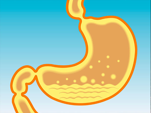 Los dolores de estómago más estelares - ¿Qué es la gastritis?