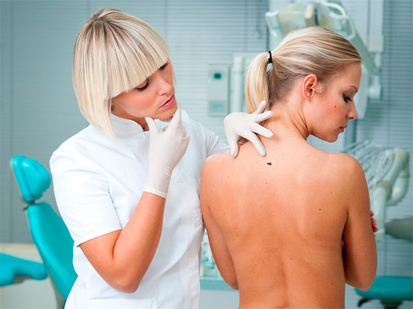 12 Súper Mujeres que vencieron enfermedades - El cáncer de piel