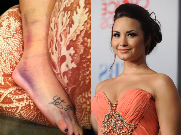 Moretones: ni los famosos se salvan - Demi Lovato y su pie morado
