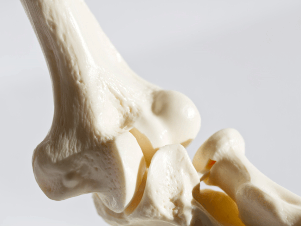 Minerales que pueden salvarte la vida - Sin calcio: osteporosis