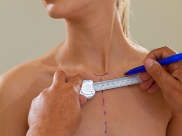 Mastectomía preventiva: extirpar los senos y evitar el cáncer - Reconstrucción del seno