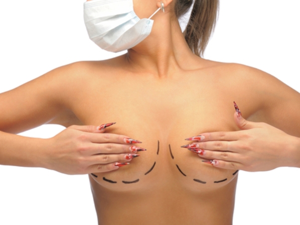 Mastectomía preventiva: extirpar los senos y evitar el cáncer - ¿Qué es la mastectomía preventiva?