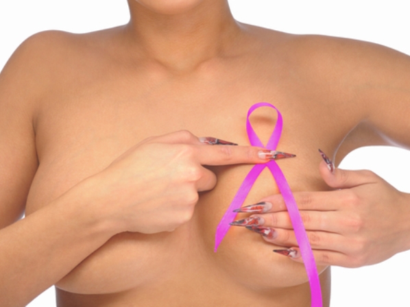 Mastectomía preventiva: extirpar los senos y evitar el cáncer - La eficacia en la prevención