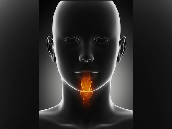 Famosos con cáncer de garganta - ¿Qué es el cáncer de garganta?