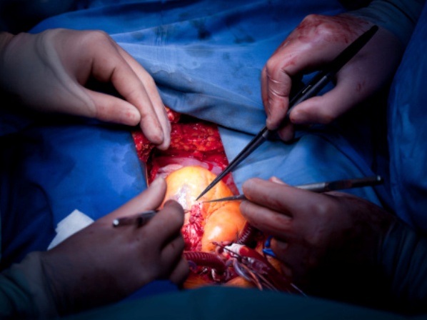 8 avances médicos asombrosos con células madre  - ¿“Sembrar” órganos en el cuerpo?