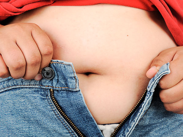 Famosos con kilos de fama  - ¿Qué es la obesidad?