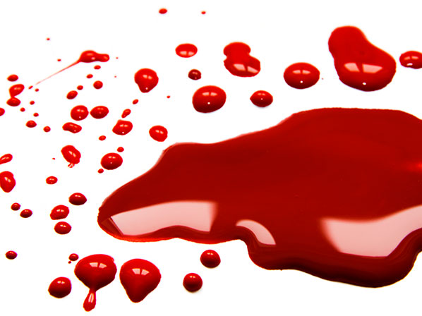 Los anémicos de la farándula - Perder sangre = anemia