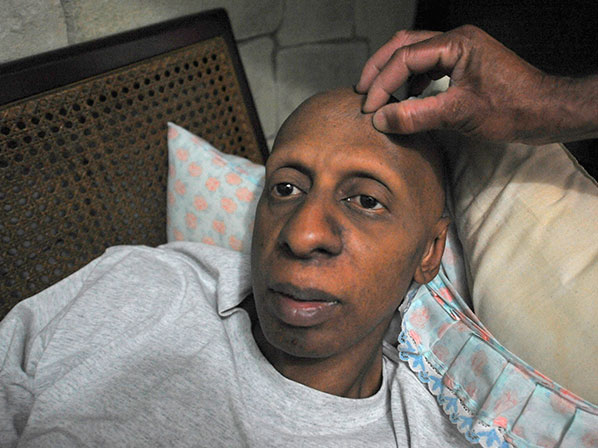 Conoce los efectos de una huelga de hambre - Guillermo Fariñas 
