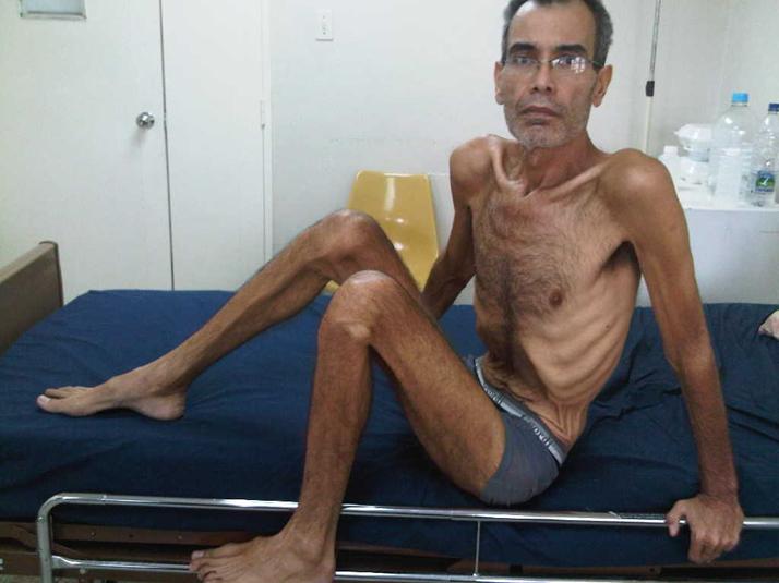 Conoce los efectos de una huelga de hambre - Franklin Brito Rodríguez