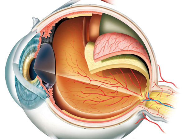 Ojo con la salud visual - Desprendimiento de la retina