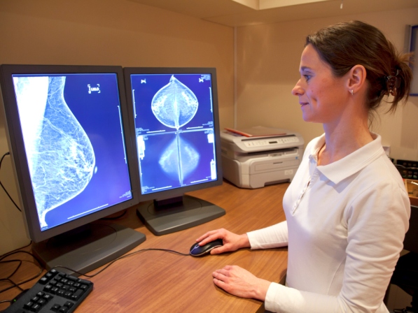 ¿Quién necesita mamografías?  - Pero muchos no coinciden 