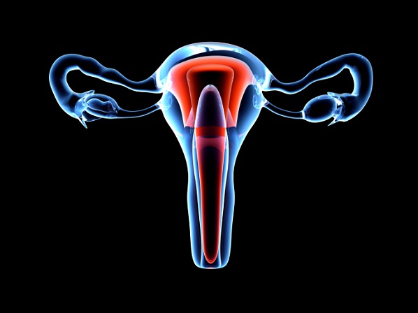 Infertilidad: que nada te impida ser mamá - Si tienes fibromas uterinos