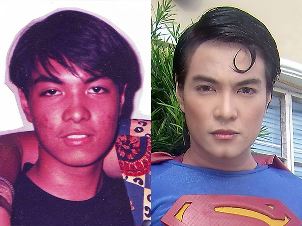 Se operan para parecerse a sus ídolos - El Superman filipino