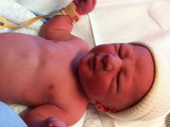 Un niño nació con 24 dedos  - Optó por la vida