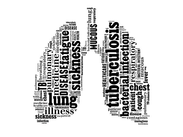 Todo lo que debes saber sobre la tuberculosis - Repercusión en el mundo