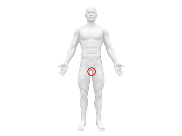 Cáncer testicular