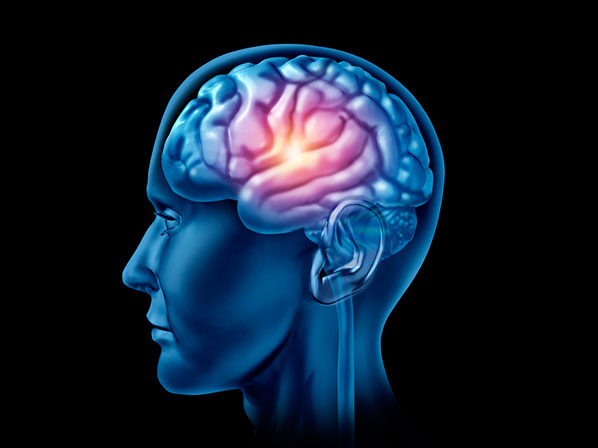 ¿Cómo prevenir un ataque cerebral? - Ignorancia, el enemigo