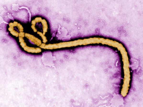 Seis enfermedades que podrían matar a millones - 3. Ébola
