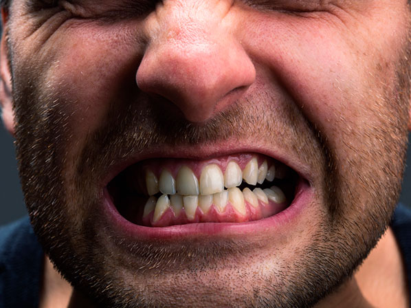 10 hábitos nerviosos que arruinan la salud - 6. Rechinar los dientes