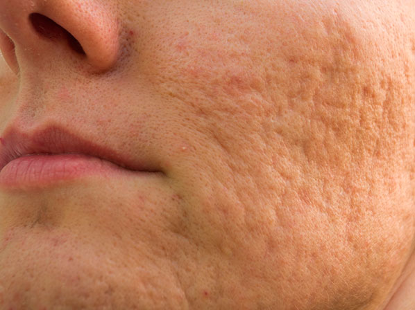 10 hábitos nerviosos que arruinan la salud - La piel habla