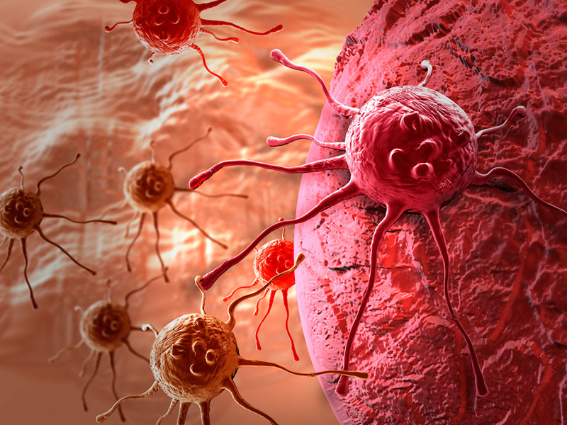 Hispanos, víctimas del cáncer de testículo - En qué radica