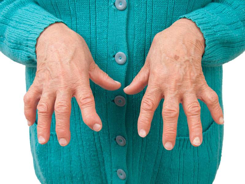 ¿Cuánto sabes de la artritis juvenil? - Contra otros males