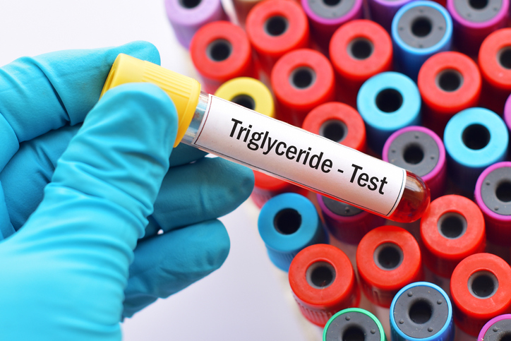 Causas y síntomas de los triglicéridos altos - Nivel saludable