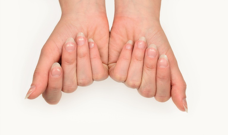 Cómo hacer para que las uñas crezcan sanas y fuertes