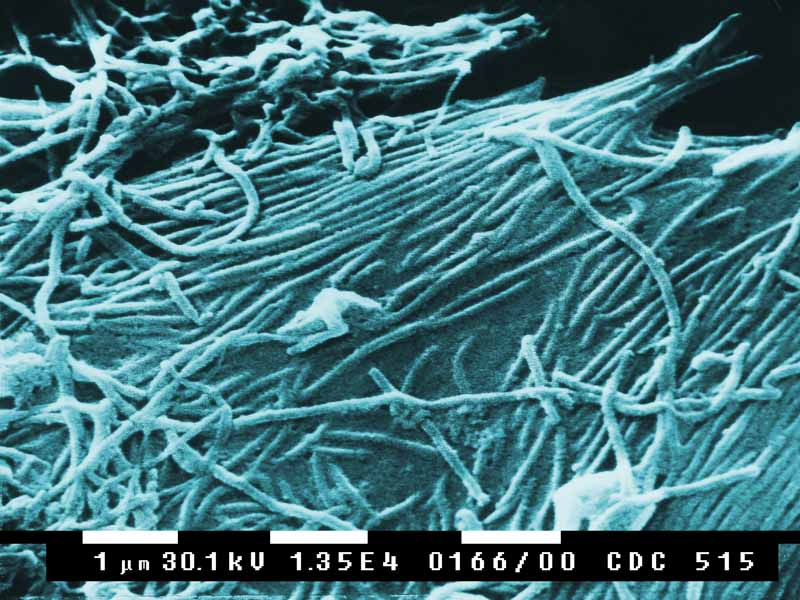 Los 7 virus hermanos del Ébola - 3. Virus Bundibugyo 