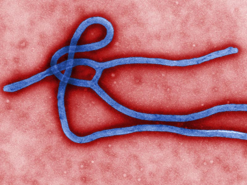 Los 7 virus hermanos del Ébola - Apellido: Filovirus