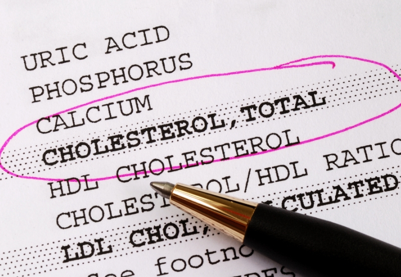 ¿Qué es el colesterol “bueno” y “malo”? - Diferencias entre los 2 tipos