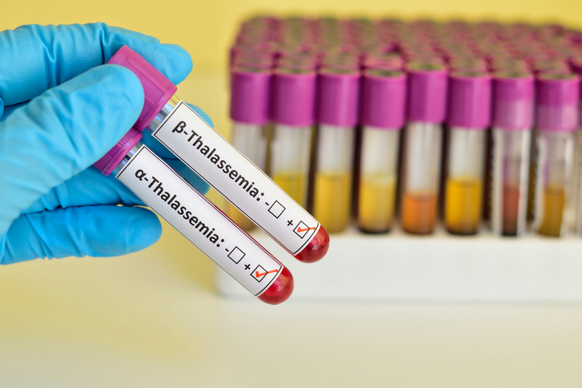 Hemofilia y otras afecciones de la sangre - Tratamiento de las talasemias