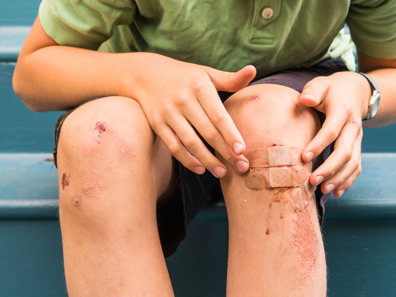 Hemofilia y tratamiento de las heridas - Heridas y raspones 