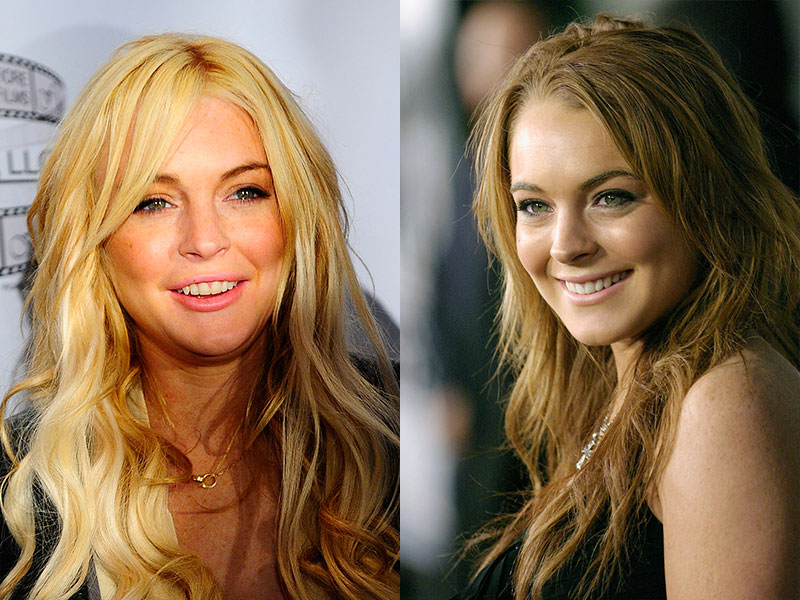 ¿Por qué se obsesionan con las cirugías? - Lindsay Lohan
