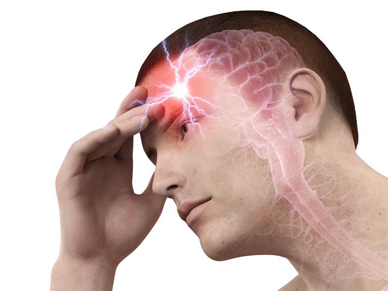 ¿Cuánto sabes sobre el ataque cerebral?