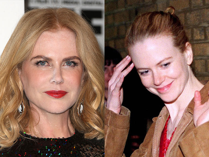 Famosos, antes y después del bisturí - Nicole Kidman
