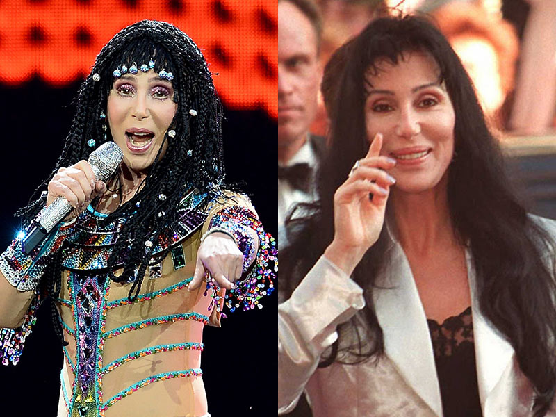 Famosos, antes y después del bisturí - Cher
