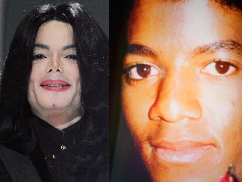 Famosos, antes y después del bisturí - Michael Jackson