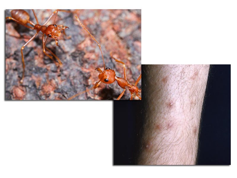 Cómo identificar qué insecto te picó - 7. Hormigas de fuego