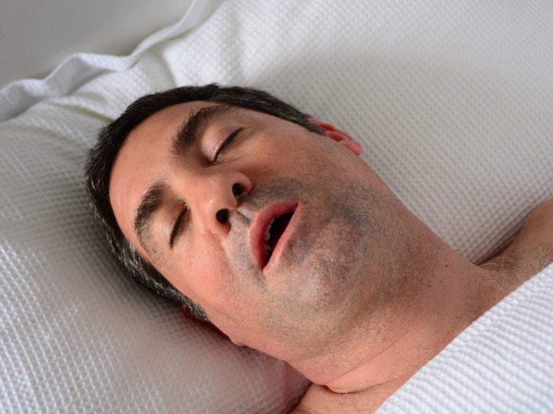 Estos son los problemas más comunes del sueño - 2. Apnea del sueño