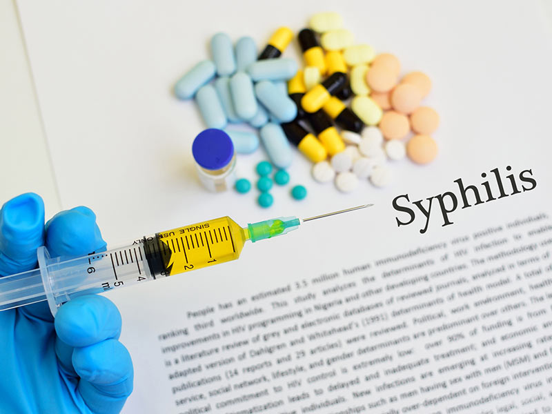 Las epidemias del 2016 - 9. Sifilis