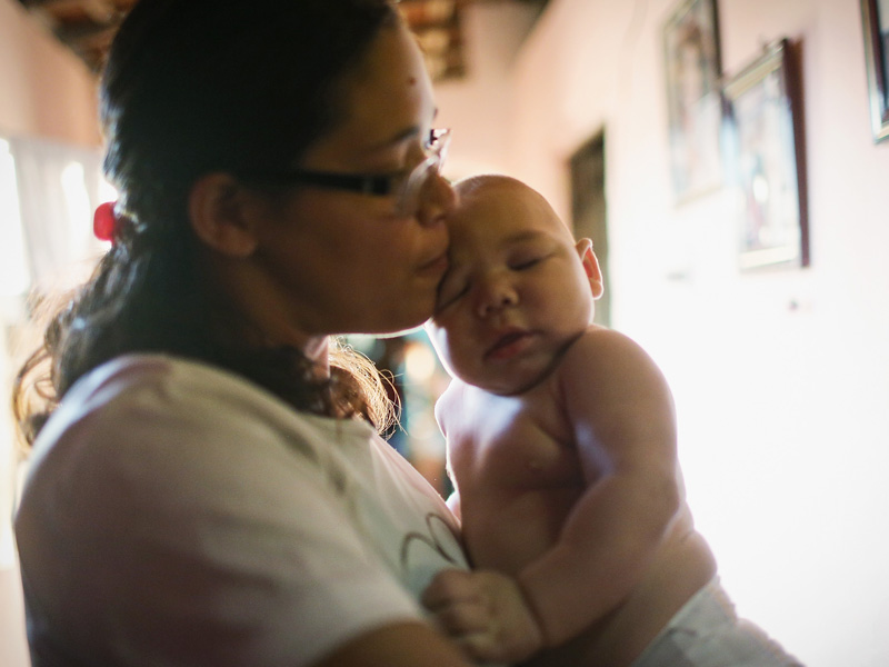 Virus del Zika y bebés con microcefalia: lo que debes saber - 