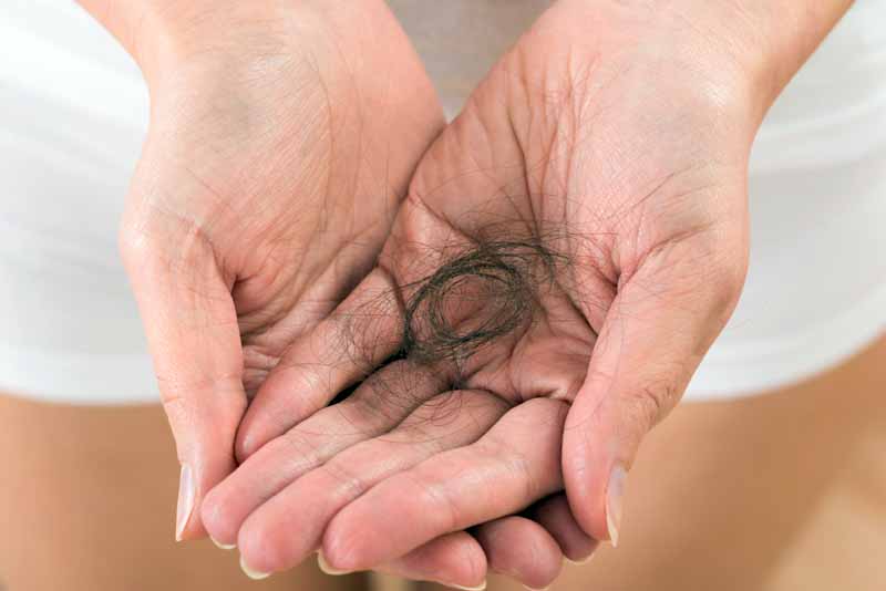 5 trucos simples para evitar la caída del cabello - 4. Piensa que podría ser algo temporario