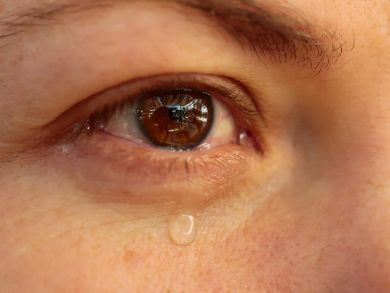 7 cosas sorprendentes que dicen los ojos sobre tu salud - 2. Ojos llorosos e irritados: alergia