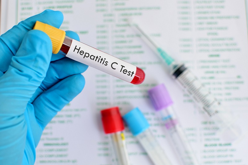 Mueren más personas por Hepatitis que por VIH ¿Cómo evitarlo? - Hepatitis C, en ascenso en EE.UU.